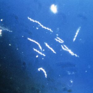 Borrelia burgdorferi